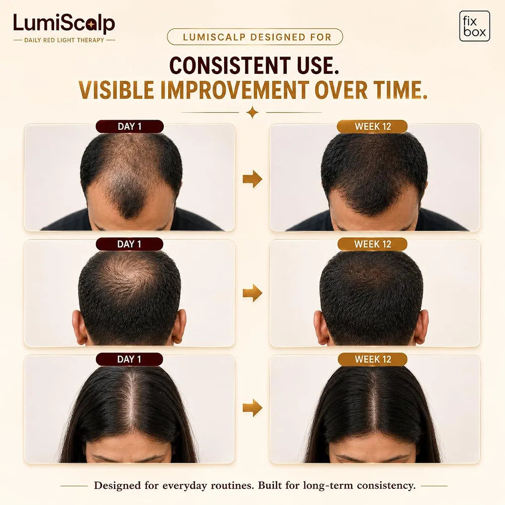 LumiScalp 54-LED Red Light Therapy Cap for Hair & Scalp Care – Rechargeable | Stop Hair Fall & Reactivate Dormant Follicles| Wireless & Discreet| Auto Session, No Side Effects & Drug-Free| LED Technology hair